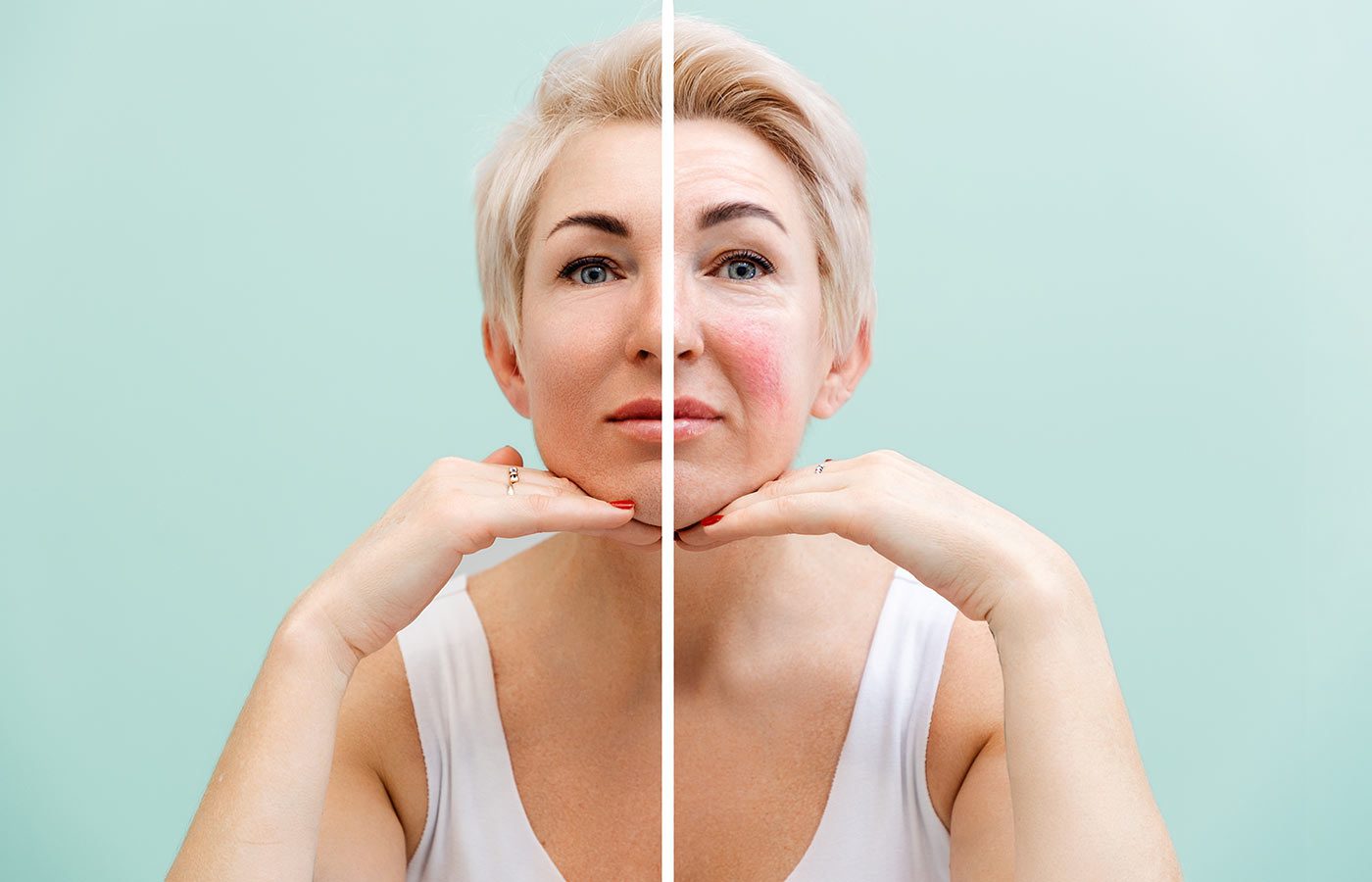 Menopause and skin changes